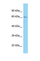 RNGTT / HCE antibody LS-C146391 Western blot of Mouse Heart lysate. Antibody concentration 1 ug/ml.