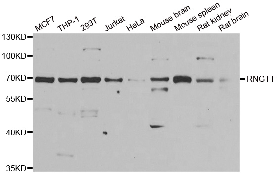 Western blot analysis of extracts of various cell lines, using RNGTT antibody.