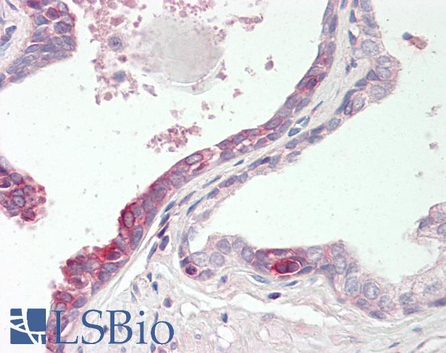 Human Prostate: Formalin-Fixed, Paraffin-Embedded (FFPE)