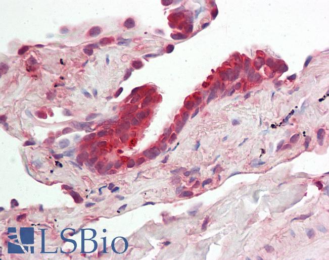 Human Lung: Formalin-Fixed, Paraffin-Embedded (FFPE)