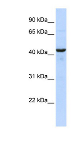 RNH1 antibody LS-C112126 Western blot of Fetal Muscle lysate.