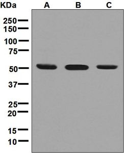 Western blot analysis on (A) HeLa, (B) 293T, and (C) Jurkat cell lysates using anti-RNMT antibody.