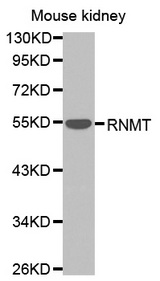Western blot analysis of extracts of mouse kidney cells lines, using RNMT antibody.