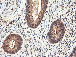 IHC of paraffin-embedded Human endometrium tissue using anti-RNPEP mouse monoclonal antibody. (Heat-induced epitope retrieval by 10mM citric buffer, pH6.0, 100C for 10min).