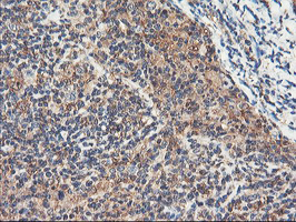 IHC of paraffin-embedded Human lymphoma tissue using anti-RNPEP mouse monoclonal antibody. (Heat-induced epitope retrieval by 10mM citric buffer, pH6.0, 100C for 10min).