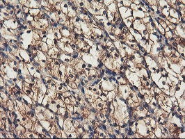 IHC of paraffin-embedded Carcinoma of Human kidney tissue using anti-RNPEP mouse monoclonal antibody. (Heat-induced epitope retrieval by 10mM citric buffer, pH6.0, 100C for 10min).