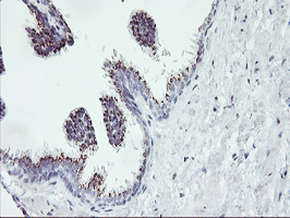 IHC of paraffin-embedded Human prostate tissue using anti-RNPEP mouse monoclonal antibody.