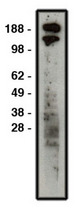 Western blot of ROBO1 antibody (LS-C140586) on HT-29 cell lysate. Lysate used at 30 ug/lane. Antibody used at 1:400 dilution. Secondary antibody, mouse anti-rabbit HRP, used at 1:50k dilution.