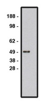 Western blot of ROBO1 antibody (LS-C140597) on human brain lysate. Lysate used at 15 ug/lane. Antibody used at 10 ug/ml. Secondary antibody, mouse anti-rabbit HRP, used at 1:50k.