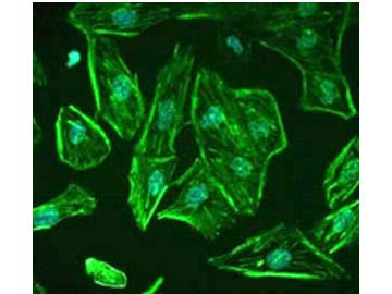 Immunofluorescence - Anti-ROBO-1 Antibody. Staining of ROBO1 in undifferentiated, immortalized human podocytes by Immunocytochemistry/ Immunofluorescence. Cells were fixed with 2% paraformaldehyde and 4% sucrose at room temperature for 10 minutes. The cells were then washed once with PBS, permeabilized with 0.3% Triton X-100 for 10 minutes and incubated with blocking solution (2% FCS, 2% BSA, 0.2% fish gelatin) for 30 minutes, before further incubation with primary Ab for 1 hour. An Alexa Fluor 488 goat anti-rabbit IgG secondary antibody was used at a dilution of 1/200. DAPI was used for nuclear counterstaining. Image from Lindenmeyer MT et al. Systematic Analysis of a Novel Human Renal Glomerulus-Enriched Gene Expression Dataset. PLoS One. 2010 July 12;5(7): e11545, Fig 5.