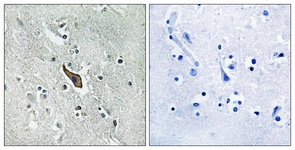 IHC of paraffin-embedded human brain tissue, using ROBO2 Antibody. The picture on the right is treated with the synthesized peptide.