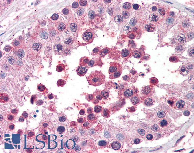 Anti-ROBO2 antibody IHC of human testis. Immunohistochemistry of formalin-fixed, paraffin-embedded tissue after heat-induced antigen retrieval. Antibody LS-B2301 concentration 5 ug/ml.