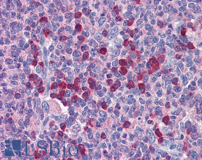Anti-ROBO2 antibody IHC of human tonsil. Immunohistochemistry of formalin-fixed, paraffin-embedded tissue after heat-induced antigen retrieval. Antibody LS-B5789 concentration 5 ug/ml.