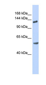 ROBO2 antibody LS-B5789 Western blot of Fetal Brain lysate.