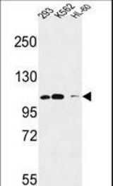 Roundabout 4 Antibody western blot of 293,K562,HL-60 cell line lysates (35 ug/lane). The Roundabout4 antibody detected the Roundabout4 protein (arrow).