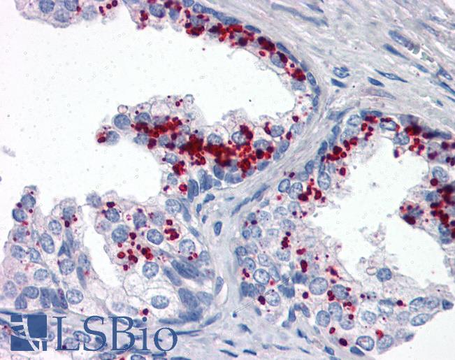 Anti-ROCK2 antibody IHC of human prostate. Immunohistochemistry of formalin-fixed, paraffin-embedded tissue after heat-induced antigen retrieval. Antibody LS-B3050 dilution 1:100.