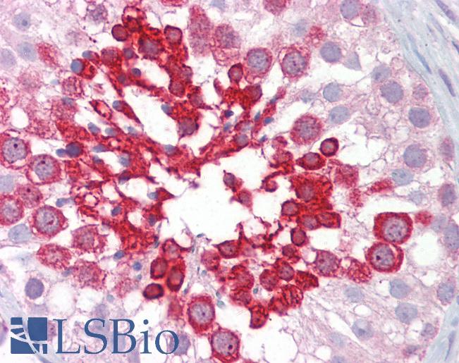 Anti-ROCK2 antibody IHC of human testis. Immunohistochemistry of formalin-fixed, paraffin-embedded tissue after heat-induced antigen retrieval. Antibody LS-B7101 concentration 5 ug/ml.