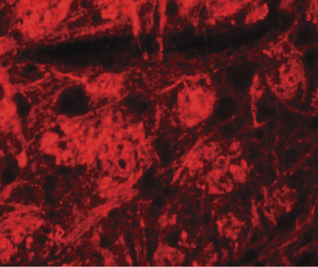 Immunofluorescence of ROCK2 in mouse brain tissue with ROCK2 antibody at 20 ug/ml.
