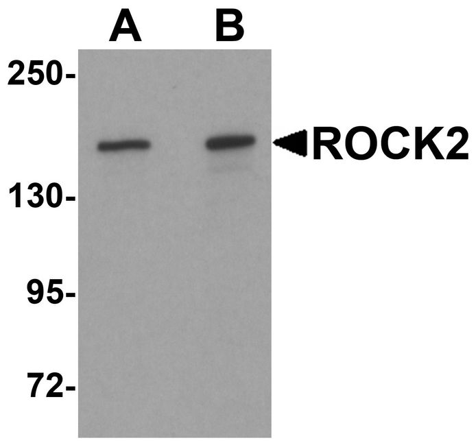Western blot analysis of ROCK2 in mouse brain tissue lysate with ROCK2 antibody at (A) 1 and (B) 2 ug/ml