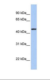 Transfected 293T cell lysate. Antibody concentration: 1.0 ug/ml. Gel concentration: 12%.