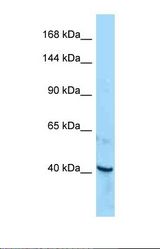 Western blot of Human HepG2 . ROR1 antibody dilution 1.0 ug/ml.