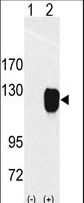 Western blot of ROR1 (arrow) using rabbit polyclonal ROR1 Antibody. 293 cell lysates (2 ug/lane) either nontransfected (Lane 1) or transiently transfected with the ROR1 gene (Lane 2) (Origene Technologies).