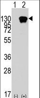 Western blot of ROR1 (arrow) using rabbit polyclonal ROR1 Antibody. 293 cell lysates (2 ug/lane) either nontransfected (Lane 1) or transiently transfected with the ROR1 gene (Lane 2) (Origene Technologies).