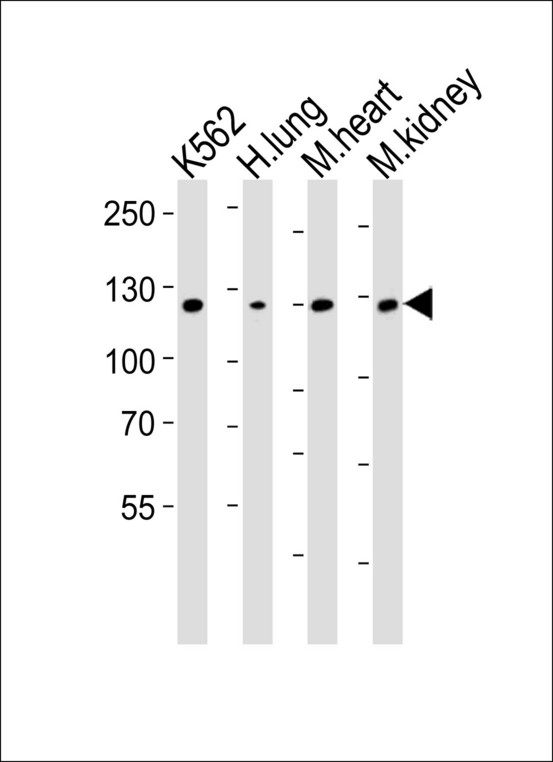 Western blot of lysates from K562 cell line, human lung, mouse heart and kidney tissue lysate(from left to right), using ROR1 Antibody. Antibody was diluted at 1:1000 at each lane. A goat anti-rabbit IgG H&L (HRP) at 1:10000 dilution was used as the secondary antibody. Lysates at 35ug per lane.