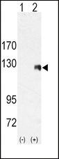 Western blot of ROR2 (arrow) using rabbit polyclonal ROR2 Antibody. 293 cell lysates (2 ug/lane) either nontransfected (Lane 1) or transiently transfected with the ROR2 gene (Lane 2) (Origene Technologies).