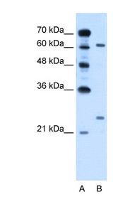 RORA antibody LS-C40523 Western blot of HepG2 cell lysate.