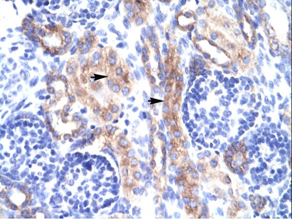 RORA antibody LS-C31274 was used in IHC to stain formalin-fixed, paraffin-embedded human kidney.