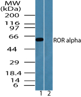 Western blot of ROR alpha in human skeletal muscle lysate in the 1) absence and 2) presence of immunizing peptide using LS-C148467 at 0.025 ug/ml.