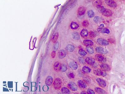 Anti-ROR Alpha / RORA antibody IHC of human skin. Immunohistochemistry of formalin-fixed, paraffin-embedded tissue after heat-induced antigen retrieval. Antibody LS-A2337 dilution 11-17 ug/ml.