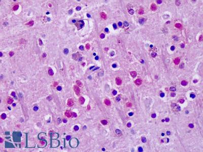 Anti-ROR Alpha / RORA antibody IHC of human brain, cortex. Immunohistochemistry of formalin-fixed, paraffin-embedded tissue after heat-induced antigen retrieval. Antibody LS-A2337 dilution 11-17 ug/ml.