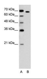 A: Marker, B: Jurkat Cell Lysate