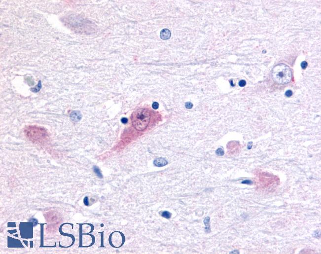 Anti-ROR Beta antibody LS-A2374 IHC of human brain, thalamus. Immunohistochemistry of formalin-fixed, paraffin-embedded tissue after heat-induced antigen retrieval.