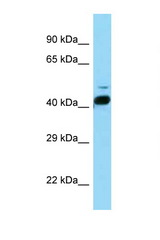 RORB / ROR-BETA antibody LS-C146204 Western blot of Mouse Brain lysate. Antibody concentration 1 ug/ml.