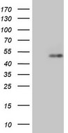 HEK293T cells were transfected with the pCMV6-ENTRY control (Left lane) or pCMV6-ENTRY RORB (Right lane) cDNA for 48 hrs and lysed. Equivalent amounts of cell lysates (5 ug per lane) were separated by SDS-PAGE and immunoblotted with anti-RORB.