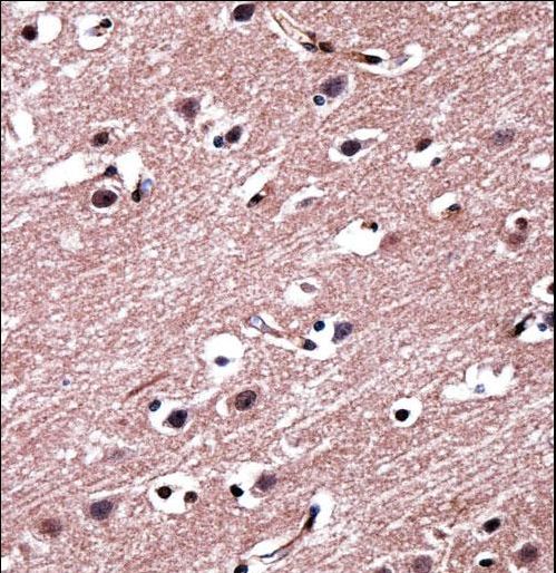 RORB Antibody immunohistochemistry of formalin-fixed and paraffin-embedded human brain tissue followed by peroxidase-conjugated secondary antibody and DAB staining.