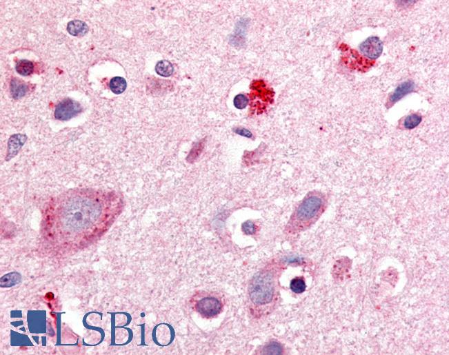 Anti-ROR Beta antibody LS-A5531 IHC of human brain, cortex. Immunohistochemistry of formalin-fixed, paraffin-embedded tissue after heat-induced antigen retrieval.