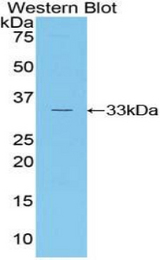 Western blot of recombinant RORC / ROR Gamma.
