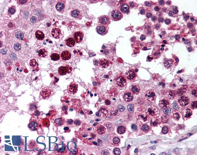 Anti-ROR Gamma antibody IHC of human testis. Immunohistochemistry of formalin-fixed, paraffin-embedded tissue after heat-induced antigen retrieval. Antibody LS-B1797 concentration 10 ug/ml.