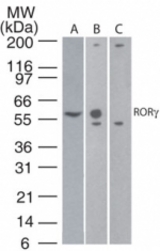 Western blot of ROR