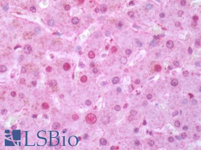 Human Liver: Formalin-Fixed, Paraffin-Embedded (FFPE)