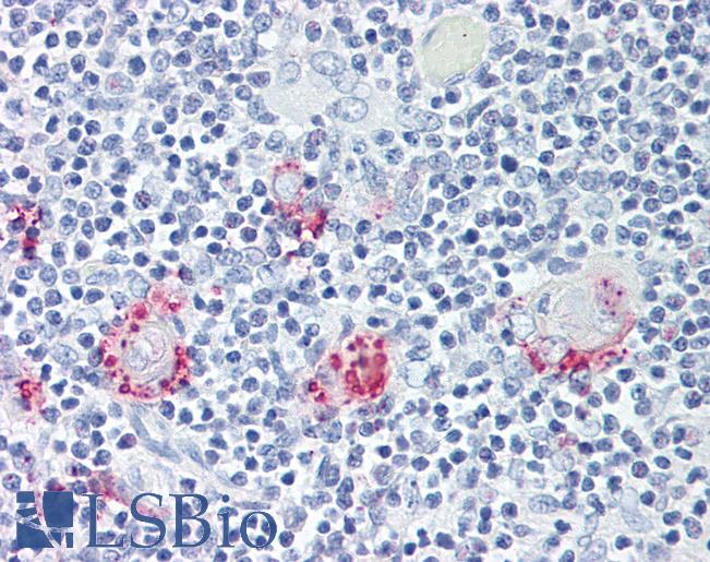 Anti-ROR Gamma antibody LS-A5200 IHC of human thymus. Immunohistochemistry of formalin-fixed, paraffin-embedded tissue after heat-induced antigen retrieval.