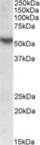RORC antibody (0.1 ug/ml) staining of Human Colon lysate (35 ug protein/ml in RIPA buffer). Primary incubation was 1 hour. Detected by chemiluminescence.
