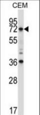 RORC Antibody western blot of CEM cell line lysates (35 ug/lane). The RORC antibody detected the RORC protein (arrow).