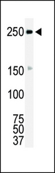 Western blot of anti-ROS antibody in HL-60 cell lysate. ROS (arrow) was detected using purified antibody. Secondary HRP-anti-rabbit was used for signal visualization with chemiluminescence.