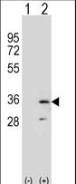 Western blot of RPA2 (arrow) using rabbit polyclonal RPA2 Antibody. 293 cell lysates (2 ug/lane) either nontransfected (Lane 1) or transiently transfected (Lane 2) with the RPA2 gene.