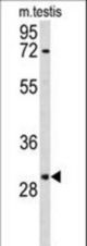 Western blot of RPA2 Antibody in mouse testis tissue lysates (35 ug/lane). RPA2 (arrow) was detected using the purified antibody.